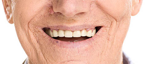 What are cosmetic dentures